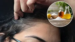 Koje su prednosti korištenja octa i sode bikarbone za tretman sijede kose i kako to pravilno napraviti?